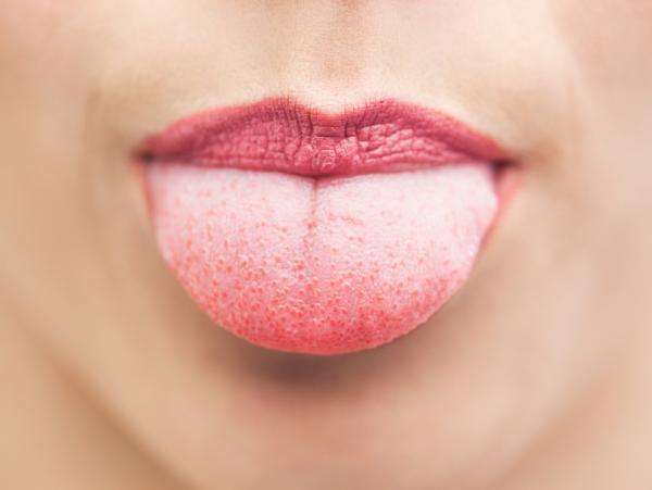 How to clean the white tongue with folk remedies