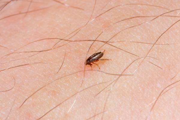 How to remove fleas in humans