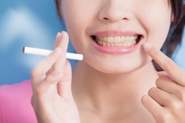 How to remove yellow stains from smoking teeth