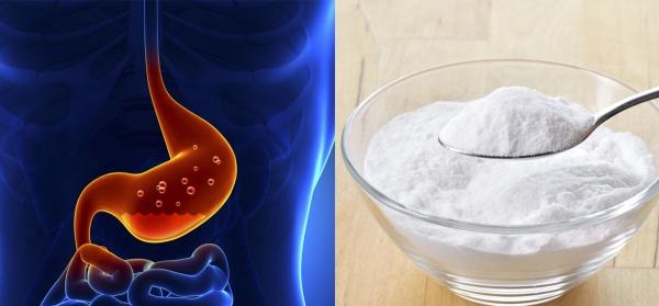 How to take baking soda for heartburn - it works