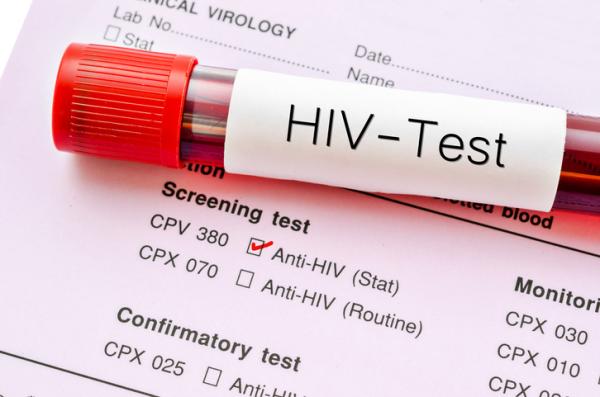 How to tell if I have HIV without going to the doctor