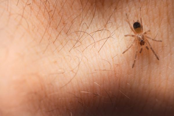 What are the symptoms of spider bite